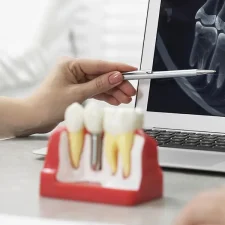 How Dental Implants Help Oral Health