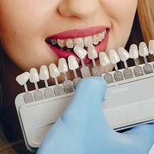 Porcelain or Zirconia- Which Material is Right for You?