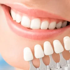 Can Dental Veneers Really Change Your Smile As Described?