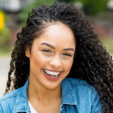 Clear Aligners Or Metal Braces? Here’s How To Choose
