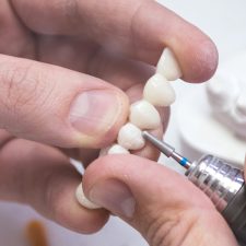 How to Choose the Right Prosthodontist Near You in Calgary