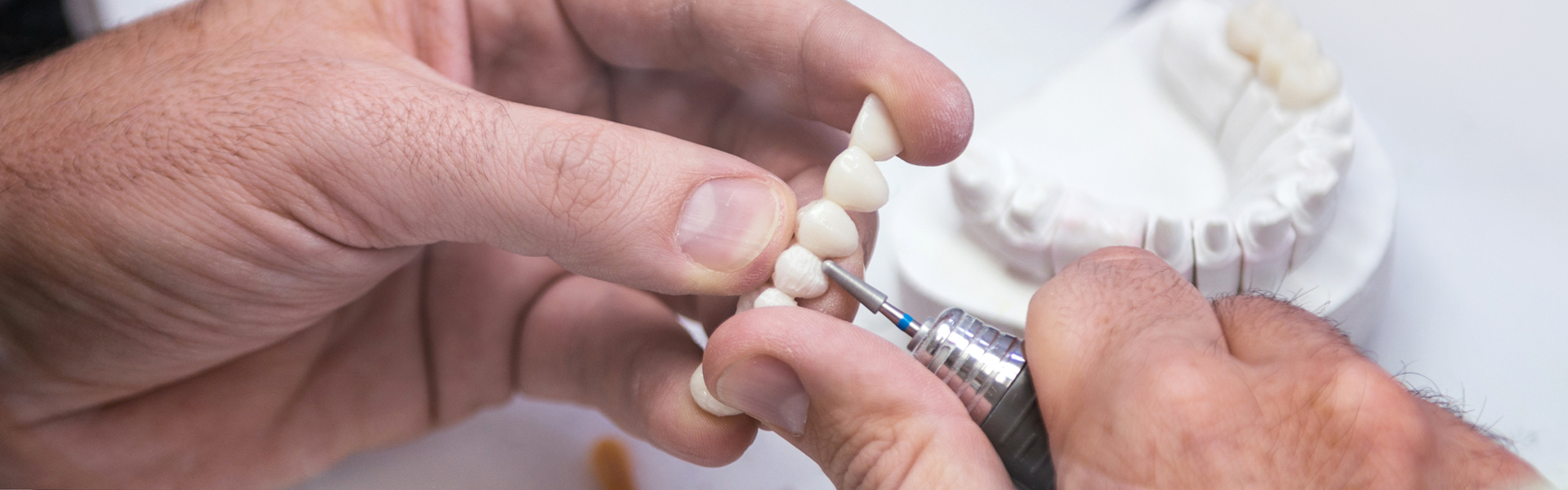 How to Choose the Right Prosthodontist Near You in Calgary