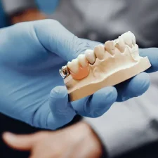 How to Choose the Right Prosthodontist Near You in Calgary